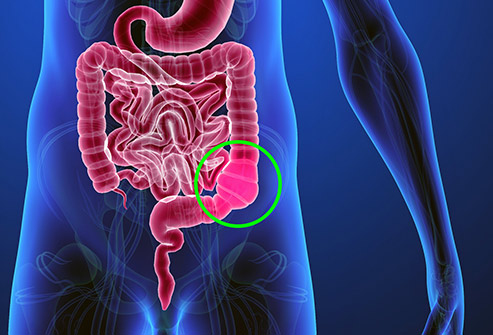 Colon Cancer Treatment Indore