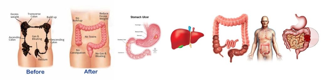colon wash in indore