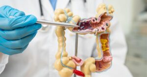 Colon therapy in indore, best constipation doctor in indore