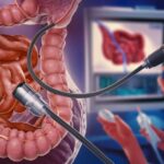Colonoscopy: essential for better digestive health.
