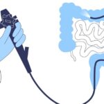 Expert Colonoscopy Care for Early Detection & Peace of Mind