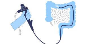 colonoscopy in indore, best colonoscopy in indore