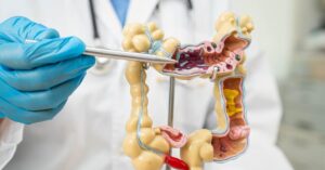 best colonoscopy in indore