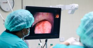 best colonoscopy Indore