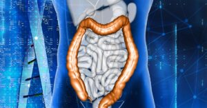 colonoscopy in indore